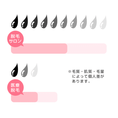 全身脱毛に必要な回数と期間は 医療脱毛 脱毛サロンは何回で終わるか徹底調査