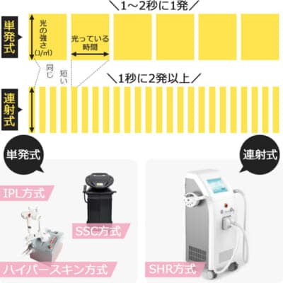 エステ光脱毛機の種類と照射速度の違い