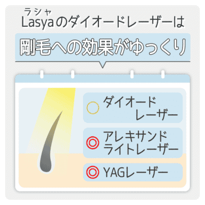 Lasyaはダイオードレーザーで、剛毛への効果がゆっくり
