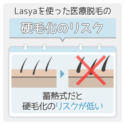 Lasyaでは、蓄熱式だと硬毛化のリスクが低い
