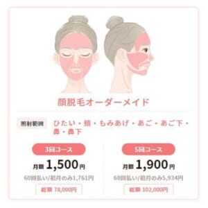 TCB東京中央美容外科の顔脱毛の料金プランの説明画像