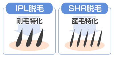 キレイモの2種類の脱毛方法がわかる画像