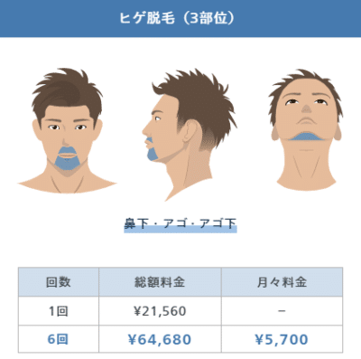 レジーナクリニックオムのヒゲ脱毛3部位プランの料金
