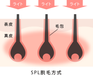 SPL方式についての解説