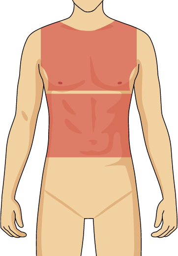ゴリラクリニックの胸・腹コースの施術範囲