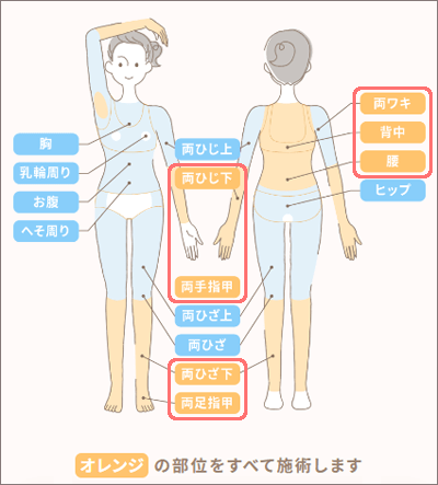 ルシアクリニックのルシア式全身脱毛の部位