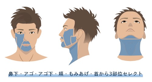 レジーナクリニックオムのヒゲ脱毛デビュープラン（3部位選択）の照射範囲