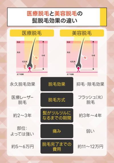 医療脱毛と美容脱毛の髭脱毛効果の違いを比較解説！
