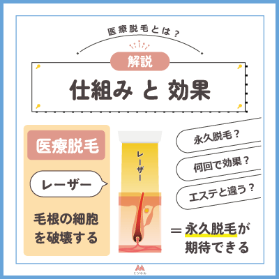 医療脱毛とは？永久脱毛がおすすめの理由とエステ脱毛との違い