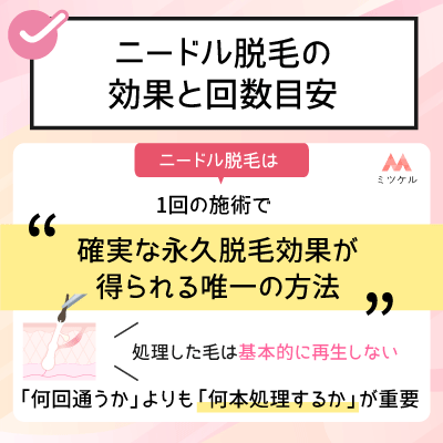 ニードル脱毛の効果と回数目安