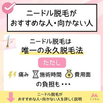 ニードル脱毛がおすすめな人・向かない人