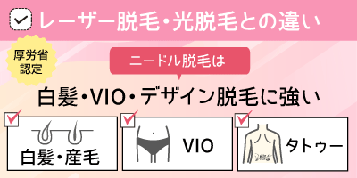 レーザー脱毛・光脱毛との違い