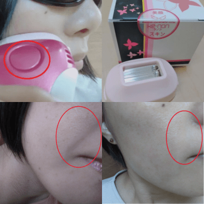 ケノン美顔器_検証ポイント