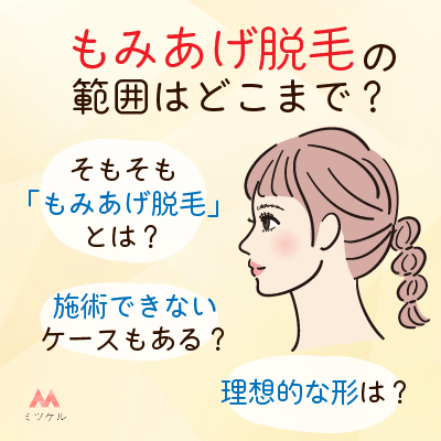 もみあげ脱毛の範囲はどこまでか紹介