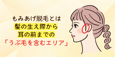 そもそも「もみあげ脱毛」とは？照射範囲をわかりやすく解説