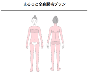 ウィンクリニックのまるっと全身脱毛プランの範囲