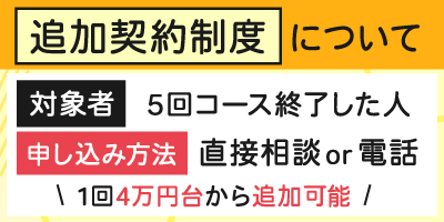 追加契約制度について