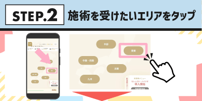 STEP2.施術を受けたいエリアをタップ
