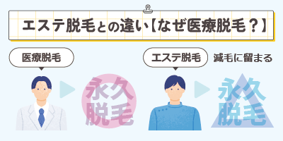 エステ脱毛との違い【なぜ医療脱毛がおすすめ？】
