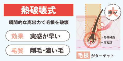 熱破壊式レーザー【剛毛に効果的な仕組み】