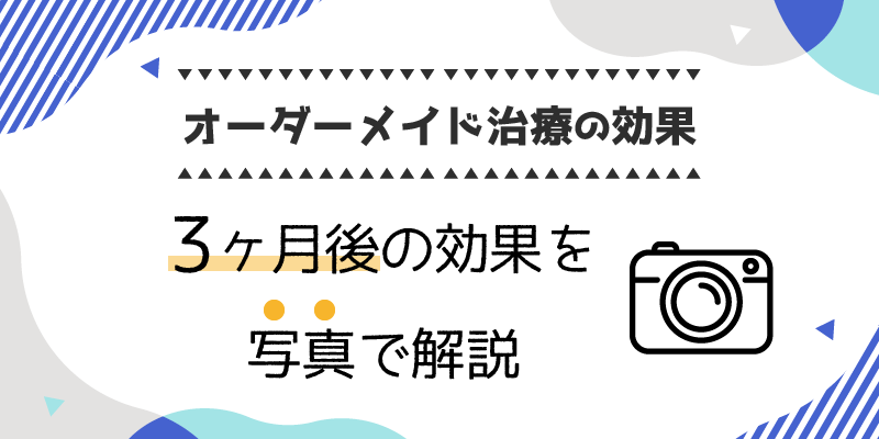 オーダーメイド治療の効果を写真付きで解説説明画像