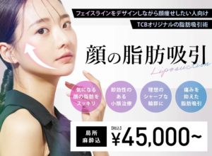 TCB東京中央美容外科_脂肪吸引の料金