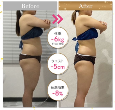 winクリニック（ウィンクリニック）の症例写真2