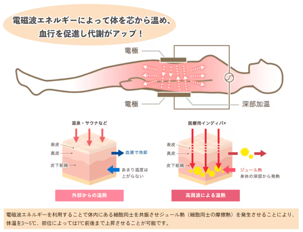 湘南美容 インディバ