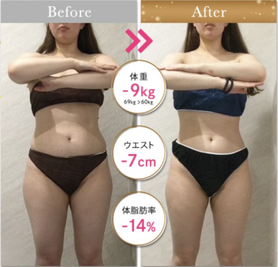WINクリニック_症例写真